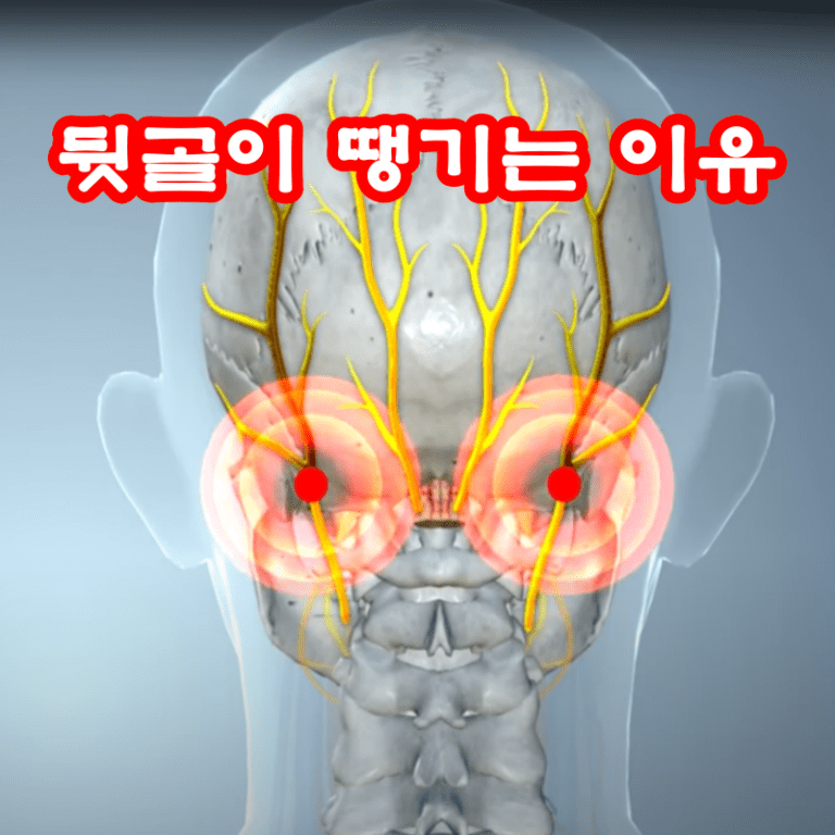 뒷골이 땡기는 이유