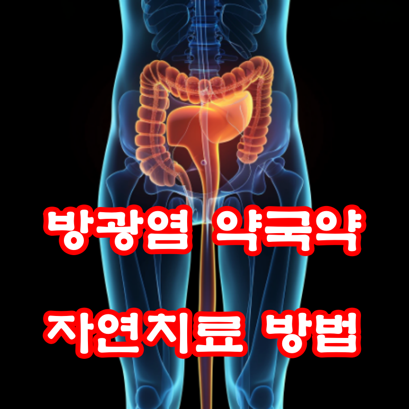 방광염 약국약과 자연치료 방법