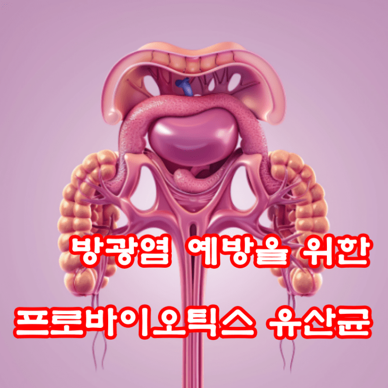 방광염 유산균