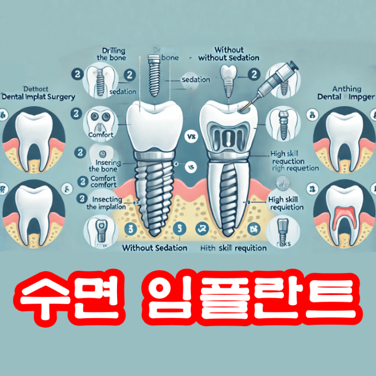 수면 임플란트